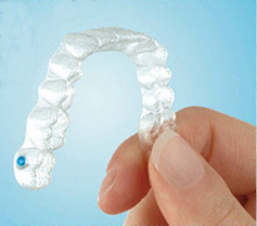 Invisalign Teen™ orthodontiste Lemay