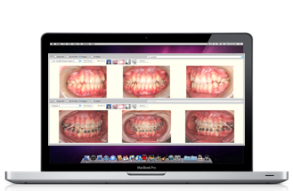 Mac computer TOPS orthodontiste sherbrooke