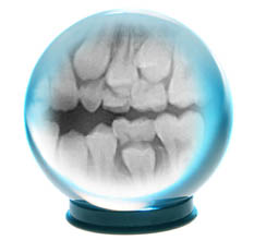 Prediction eruption radiographie orthodontiste lemay v2