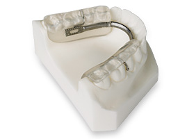 Gelb splint plaque ATM gouttière sectorielle orthodontie sherbrooke