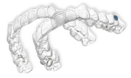 invisalign teen ortholemay