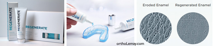 Dentifrice Regenerate toothpaste pour décalcification, érosion et caries dentaires