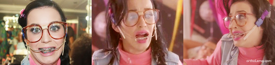 Laty Perry avec un headgear orthodontique