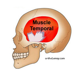Muscle de mastication temporal attaché à la mandibule.
