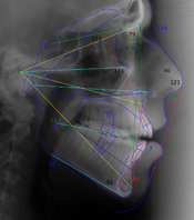 Treatment simulation tracing ceph