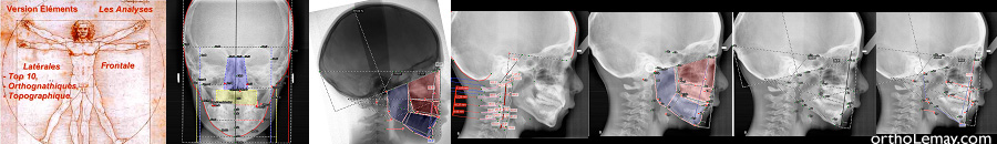 logiciel de céphalométrie architecturale “Delaire évolution 2013?