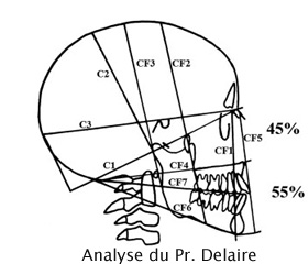 analyse cephalometrique delaire