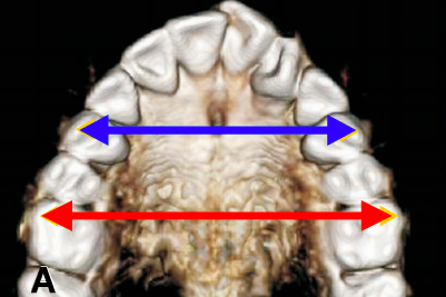 Expansion EPRAM – Une alternative à l’EPRAC