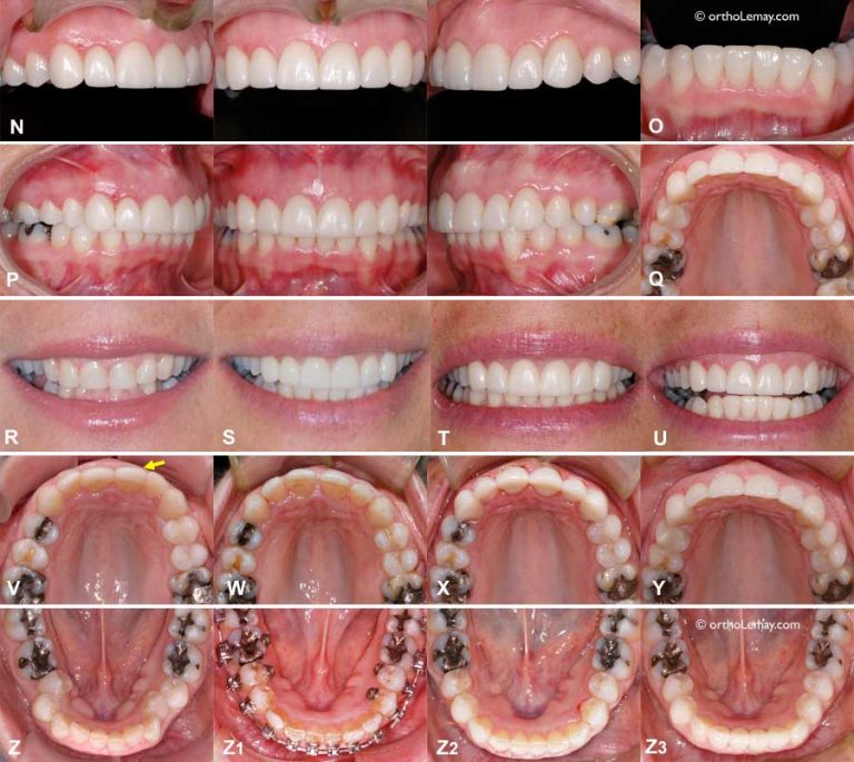 Inter-disciplinary orthodontics | Bücco